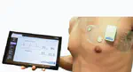 Electrophysiological Classification