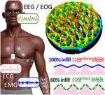 Micropatterned Biphasic Printed Electrodes for High-Fidelity on-Skin Bioelectronics