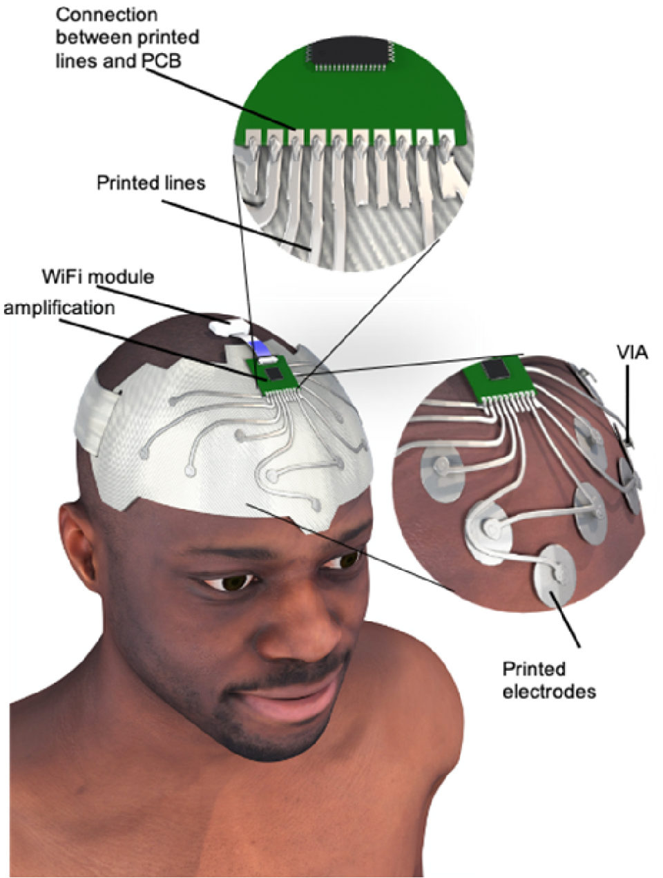 Wearable and comfortable etextile headband for longterm acquisition of forehead EEG signals